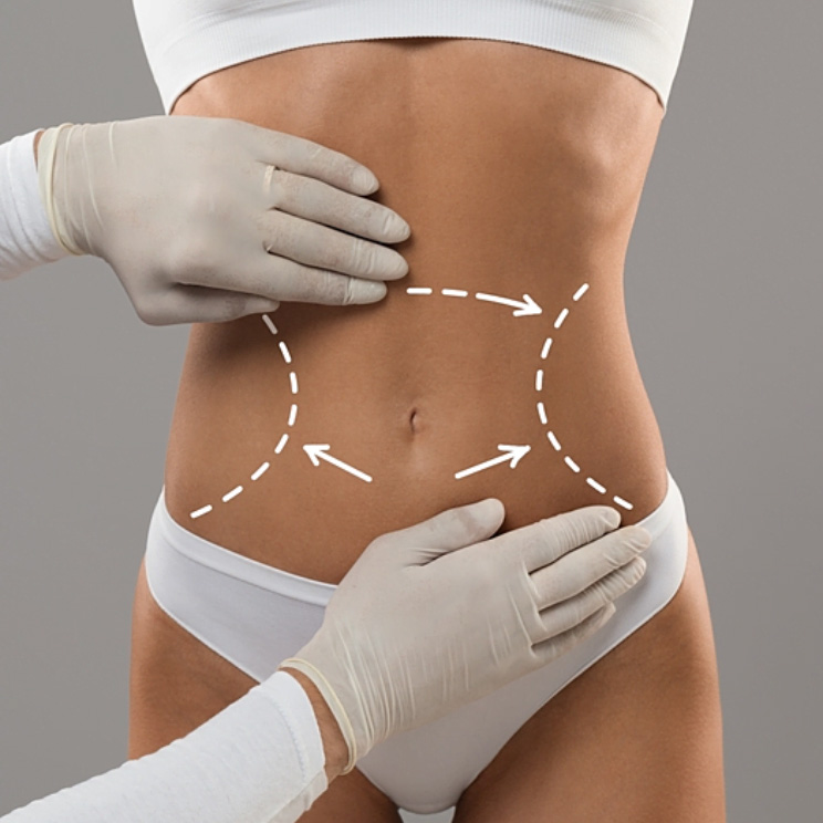 360 WAIST CONTOURING