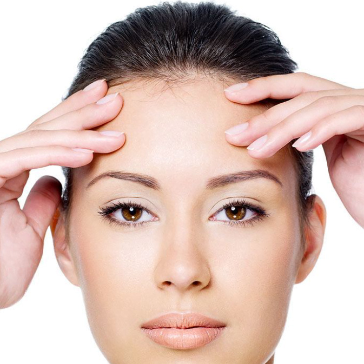 BROW LIFT