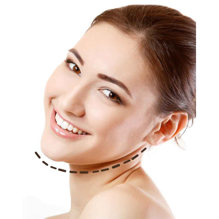 CHIN AUGMENTATION